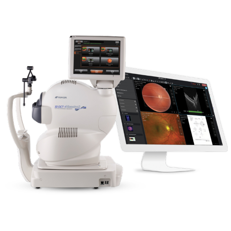 octscanner